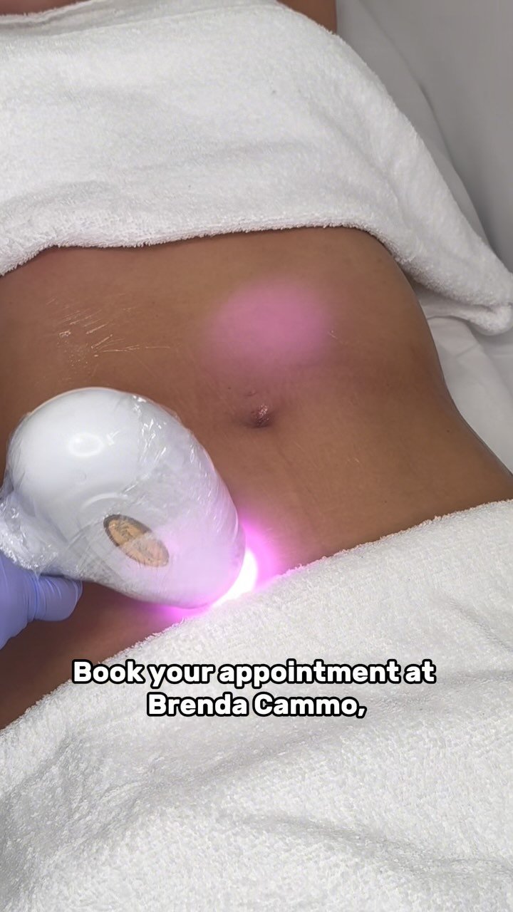 Laser Hair Removal at BeCammo, Malta